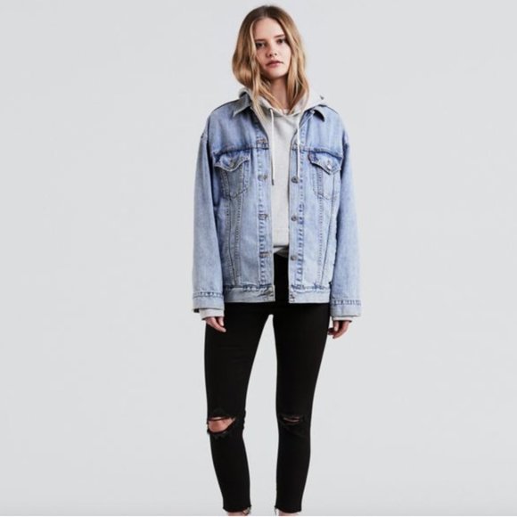 wedgie fit skinny jeans